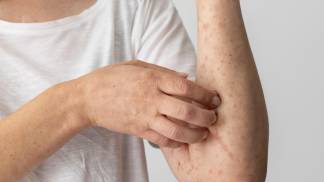 skin-allergy-reaction-person-s-arm